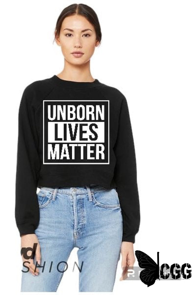 Unborn Lives Matter Design Shirt